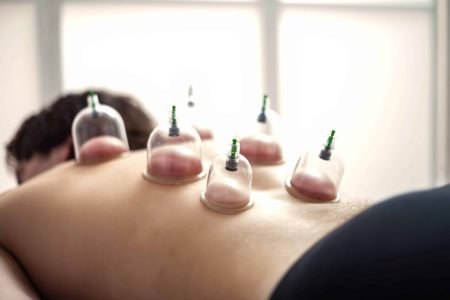 Vacuum cups therapy, sporty man lying down with vacuum cups on back in medical clinic office, visit doctor. Wellness cupping massage rehabilitation. Rehab relaxing massage concept. Copy ad text space